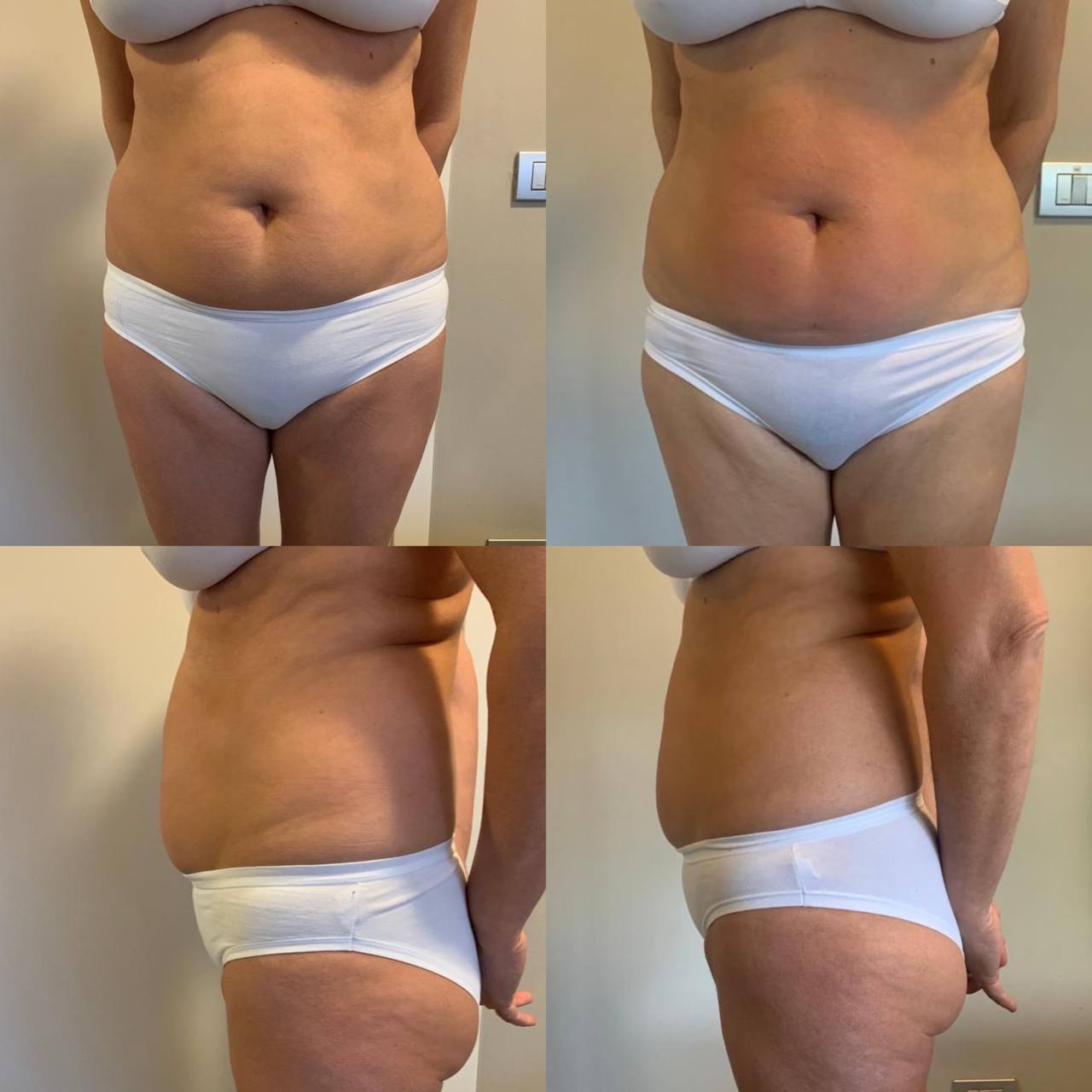 Gel cover pesca naturale e cuticole curate